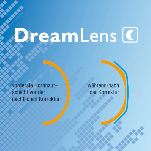 dreamlens